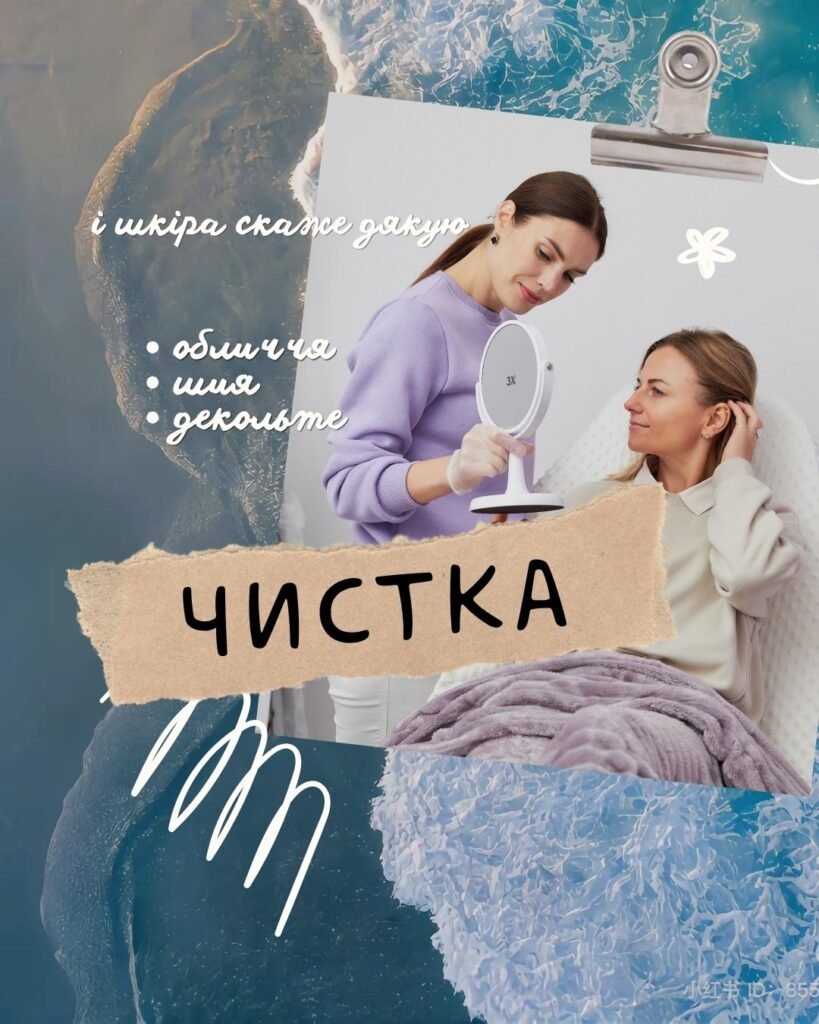 chystka 06