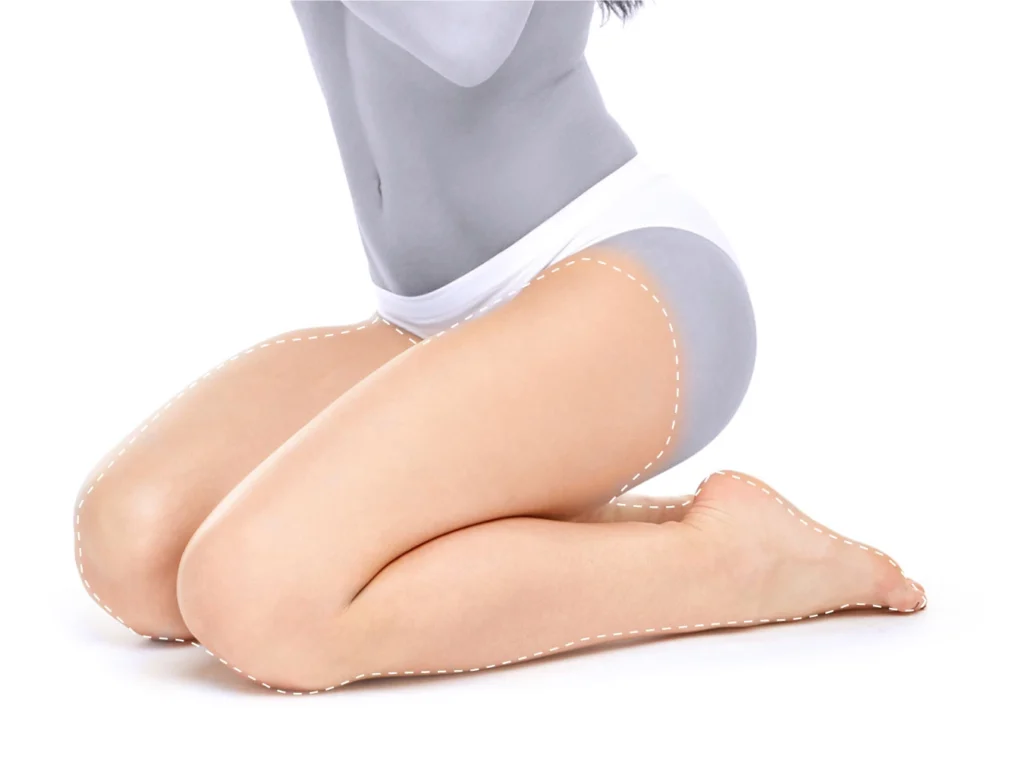 nogi povnistyu