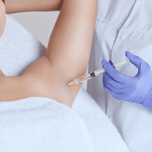 gipergidroz lazergud