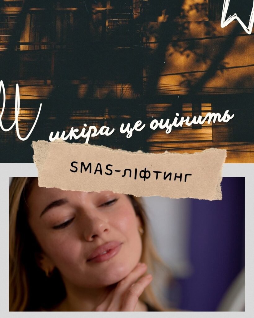 smas 067