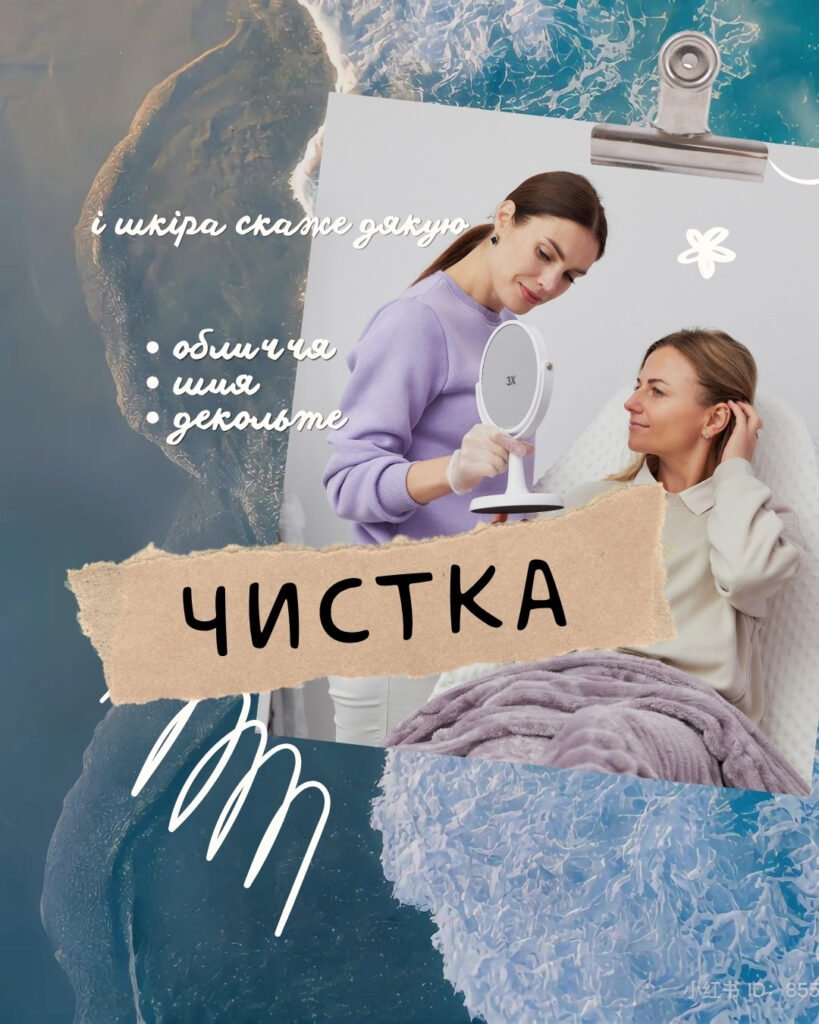 chystka 06